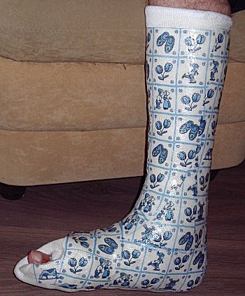 Gips versieren